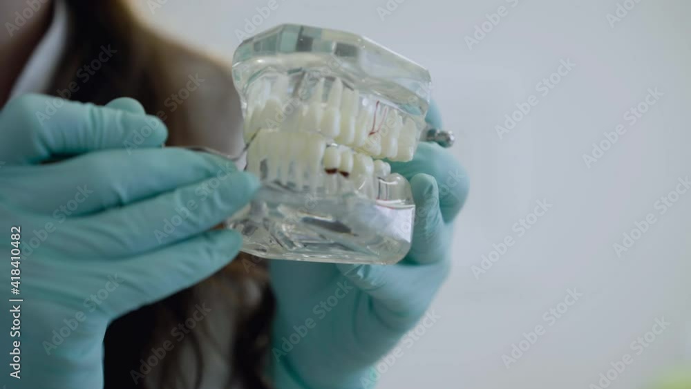 Dentist's hands showing features of dental problems on jaw layout at camera Dentist's hands showing features of dental problems on jaw layout at camera