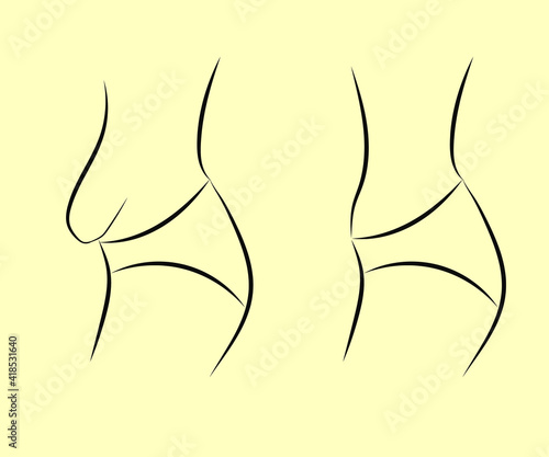 Side view of a female body on a white background. Slimming. Abdomen after childbirth. Vector illustration.
