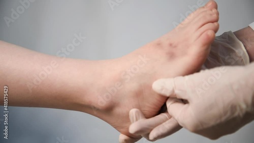 The doctor gently feels the child's foot. Bruises are visible on the patient's leg. Appointment with a doctor. Surgeon, traumatologist or orthopedist. Palpation. Bruise or fracture