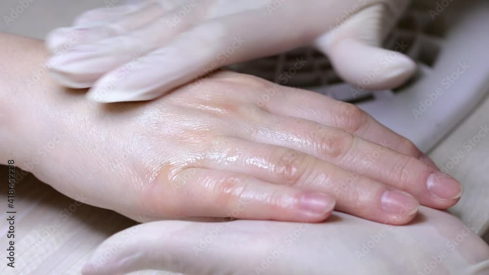 The beautician makes a hand massage with cosmetic healing oil. Dry skin of the fingers. Hand care during the cold period. The beautician makes a hand massage with cosmetic healing oil. Dry skin of the fingers. Hand care during the cold period.