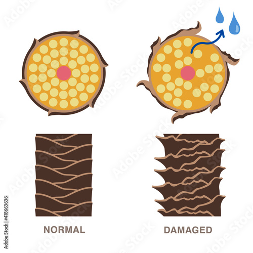 Normal and damaged hair. Damaged hair loses moisture. Smooth and damaged cuticle. vector illustration. 