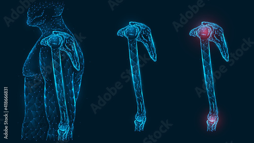 Pain, injury and inflammation of the shoulder and elbow joints side view polygonal illustration on a blue background. Healthy and sore joints.