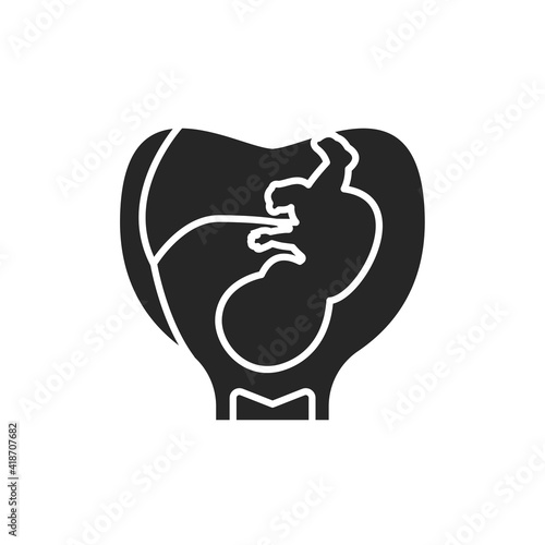 Pregnancy stage embryo in uterus with umbilical cord black glyph icon. Growth fetus development. Pictogram for web page, mobile app. UI UX GUI design element. Editable stroke.
