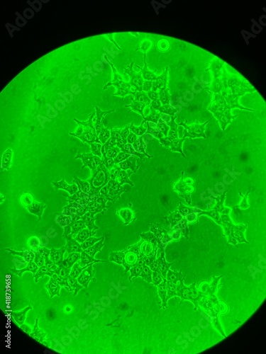 Human cells uner the microscope 