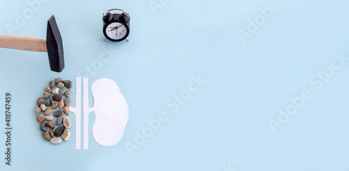 a model of a human kidney made of paper and stones, a hammer and a clock on a blue background. the concept of timely kidney treatment photo