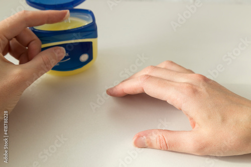 Woman hand care with vaseline cream on the white background.