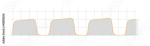 Arterial pulse waveformCapnography Waveform monitoring. Normal Curve	