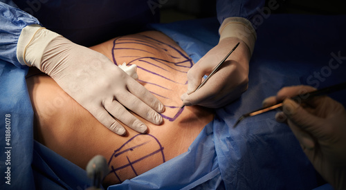 Bilde på lerret Close up of plastic surgeon hands in sterile gloves using scalpel while doing plastic surgery in clinic