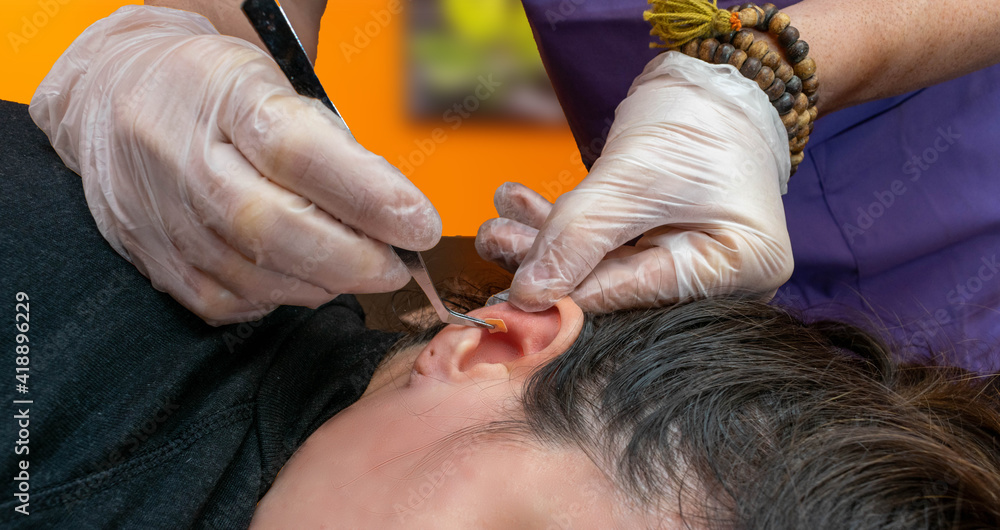 terapeuta de auriculoterapia poniendo agujas , semillas y chinchetas en la oreja de una paciente durante una sesión de auriculoterapia - obrazy, fototapety, plakaty 