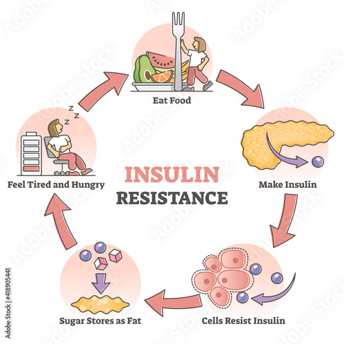 Insulin resistance pathological health condition educational outline diagram