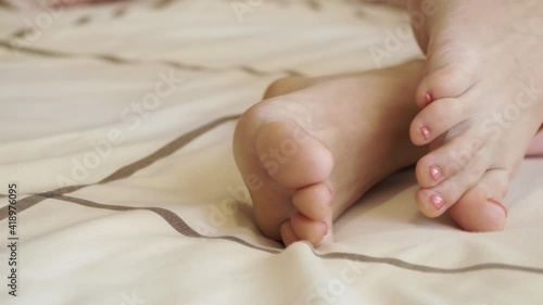 Close up of woman feet with pink pedicure. Cuticles need treatment.  Small mole peeling skin itchy feet problem. Podiatrist chiropodist patient