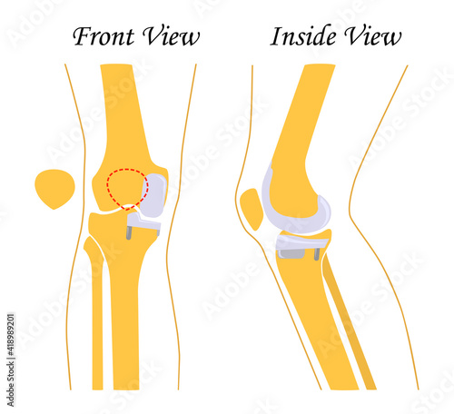 Human knee  leg  front and back view. Vector illustration. Flat design