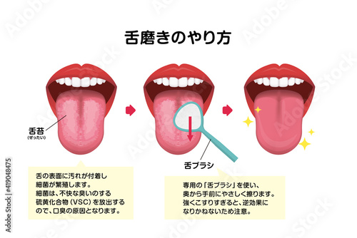 舌磨き・舌掃除のやり方 ベクターイラスト (口臭予防)
