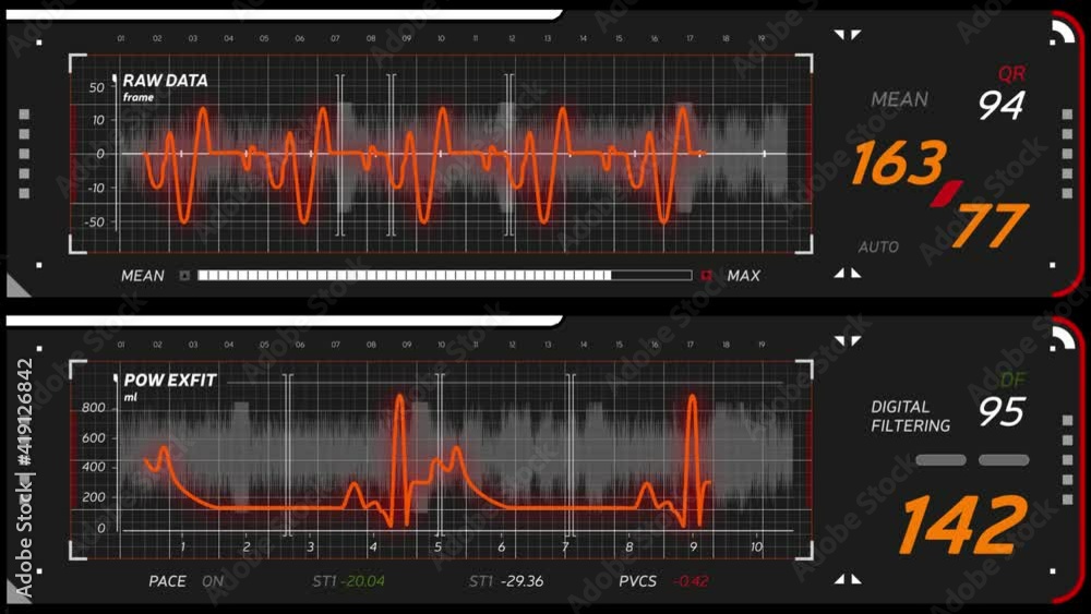 Animation of schematic diagram of human heart rhythm. ECG abstract HUD. Heart beat line template for medicical scene. Alpha channel included. Animation of schematic diagram of human heart rhythm. ECG abstract HUD. Heart beat line template for medicical scene. Alpha channel included.