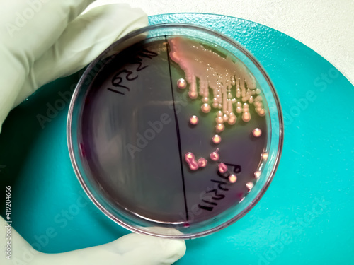 Colony Characteristics of Escherichia coli (E. coli) is a Gram-negative, facultatively anaerobic, rod-shaped, coliform bacterium of the genus Escherichia that is commonly found in the lower intestine photo