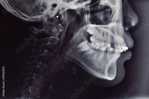 x-ray image of a human skull