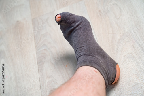 Foto old holey sock on the leg