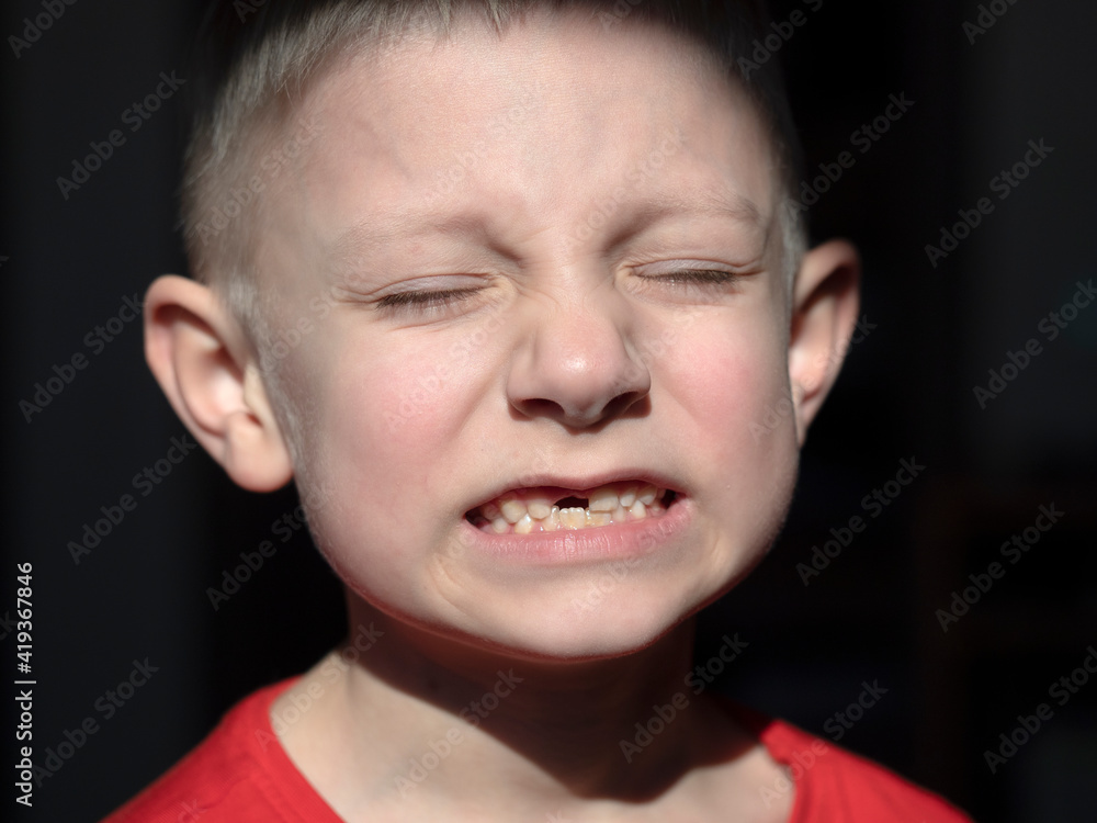Boy without front tooth Boy without front tooth