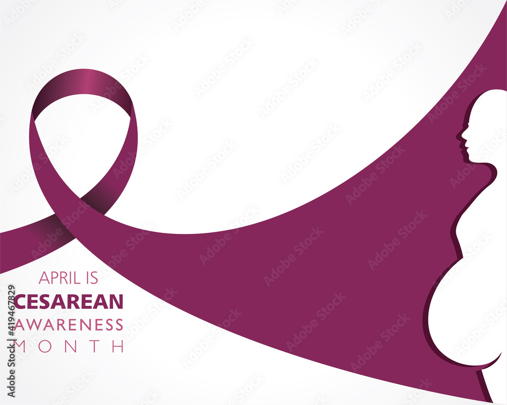 Cesarean Awareness Month observed in the month of April Cesarean Awareness Month observed in the month of April