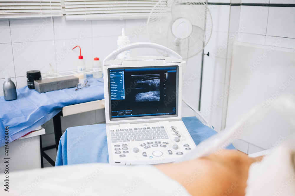 Ultrasound machine on a table with a blue cloth next to a patient lying on a stretcher in a hospital Ultrasound machine on a table with a blue cloth next to a patient lying on a stretcher in a hospital