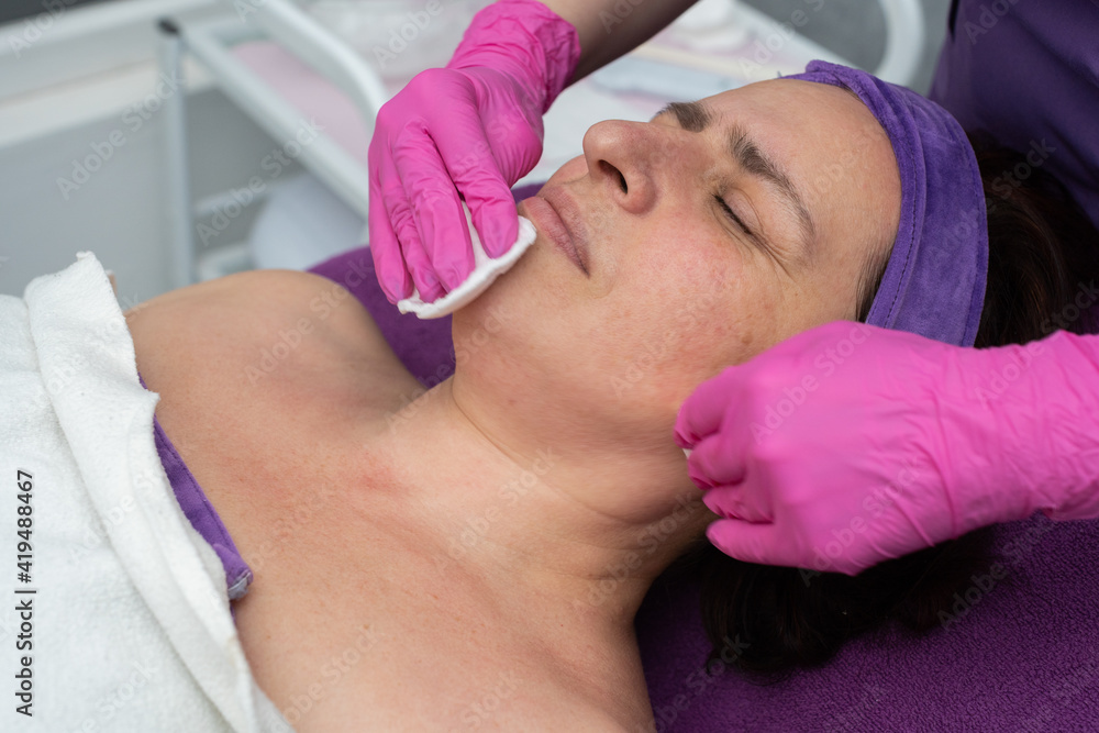 During the cosmetic procedure, the beautician wipes the skin on the face with cosmetic pads During the cosmetic procedure, the beautician wipes the skin on the face with cosmetic pads