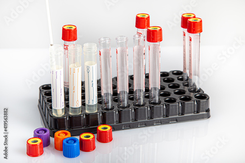 Blood test tubes in tray for laboratory testing