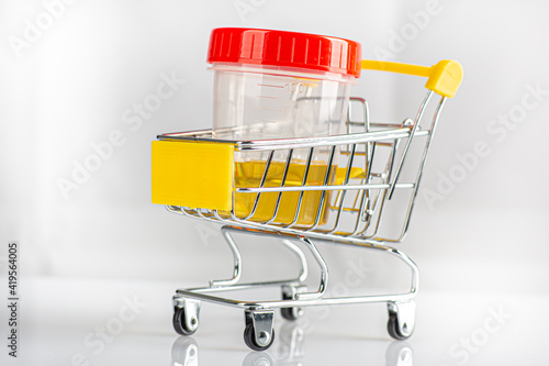 Labotatory container with human urine for medical test