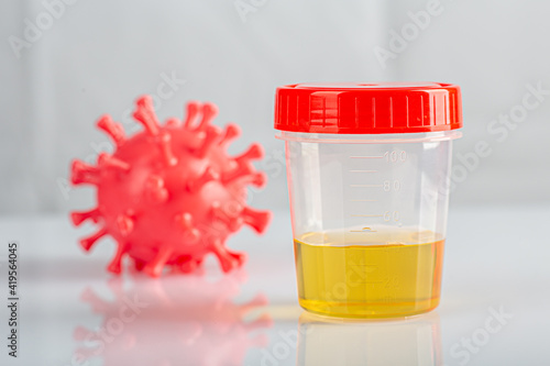 Labotatory container with human urine for medical test