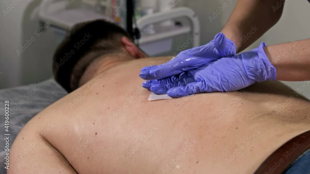Close-up. Master performs epilation procedure in the beauty spa. Waxing hair on the back of a man. Close-up. Master performs epilation procedure in the beauty spa. Waxing hair on the back of a man.