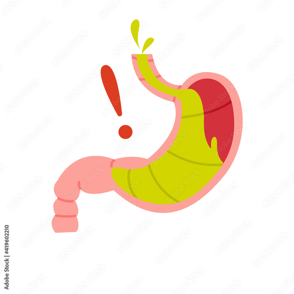 Fototapeta premium Nausea, vomiting isolated vector illustration. Unhealthy stomach, gastric problems design element. Tract diseases, gut inflammation 