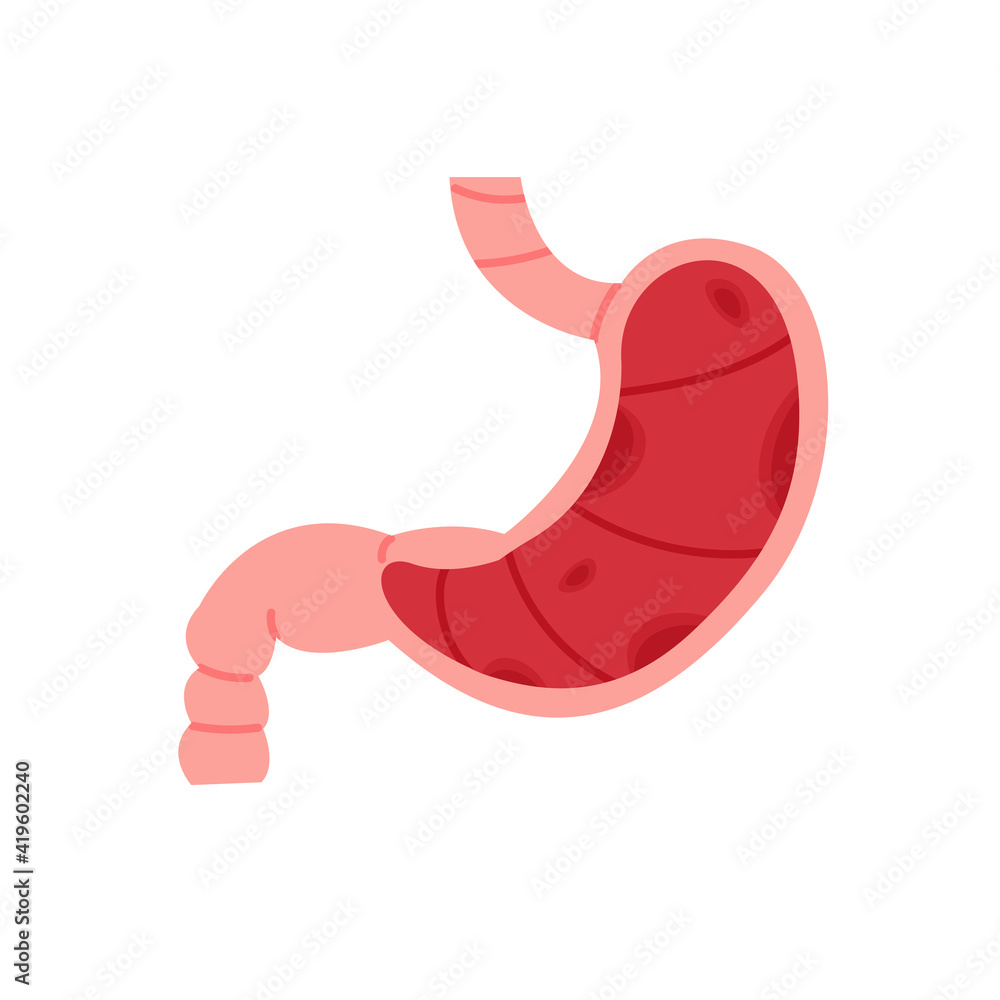 Stomach ulcer isolated vector illustration. Gut disease, cancer symptom, erosion and gastritis design element. Stomach ulcer isolated vector illustration. Gut disease, cancer symptom, erosion and gastritis design element.