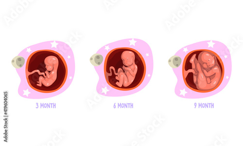 Stages of Embryo Development Set, 3, 6, 9 Month Cartoon Vector Illustration