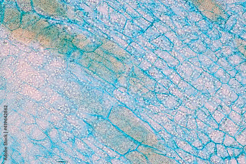 Characteristics of fungi living in wood as a group, are polyphyletic under the microscope for education.
Characteristics of fungi living in wood as a group, are polyphyletic under the microscope for education.