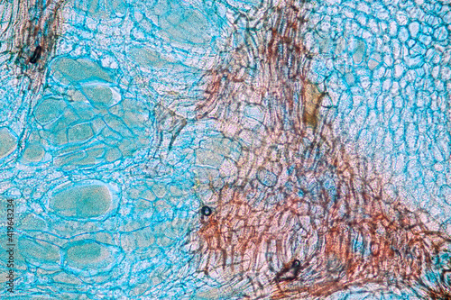 Characteristics of fungi living in wood as a group, are polyphyletic under the microscope for education.
 photo