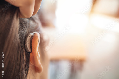 Modern digital in the ear hearing aid for deafness and the hard of hearing patients. Young woman with hearing aid indoors. Young woman with hearing aid on light background. Copy space photo
