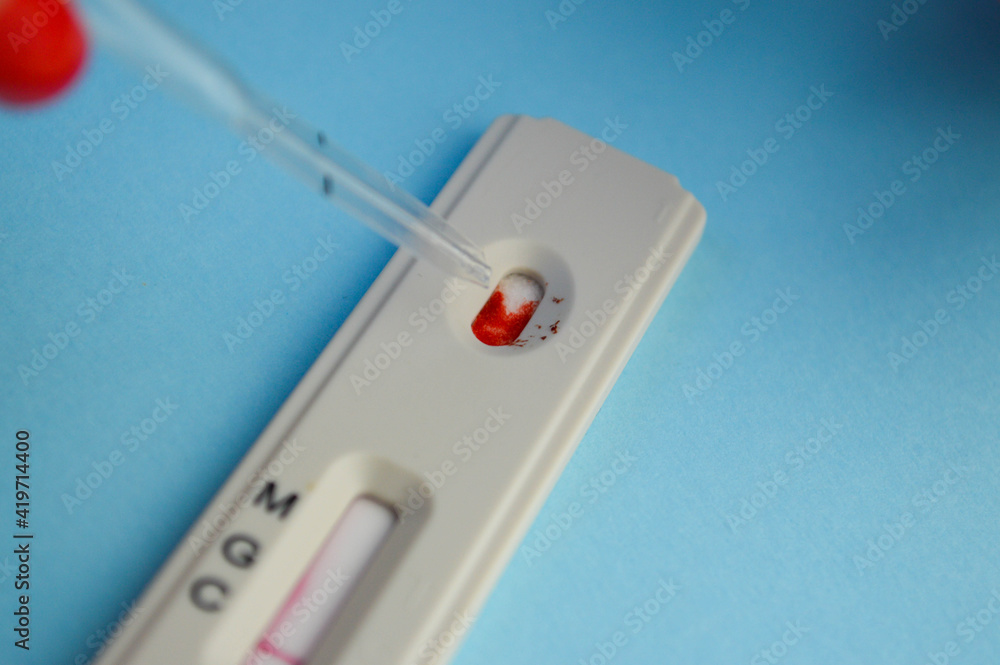 test for coronavirus on a blue background. girl with a bright red manicure makes a blood test. determination of IgG and IgM antibodies test for coronavirus on a blue background. girl with a bright red manicure makes a blood test. determination of IgG and IgM antibodies