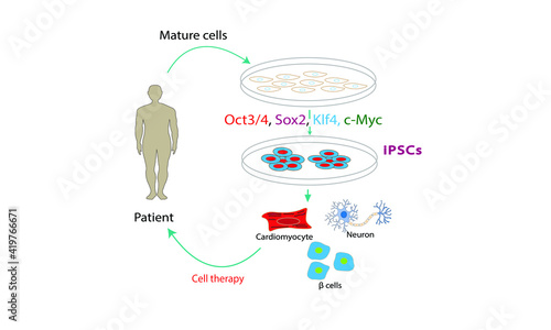 iPSCs [Induced pluripotent stem cells]
