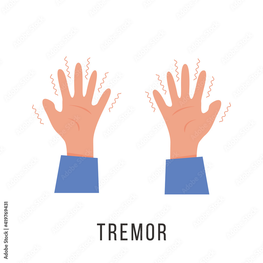 Hands with tremor symptom. Parkinson disease. Trembling or Shivering ...