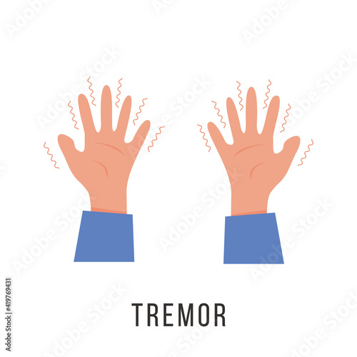 Hands with tremor symptom. Parkinson disease. Trembling or Shivering arms. Physiological stress symptoms. Mental disorders, panic, fear. Vector illustration in flat cartoon style.