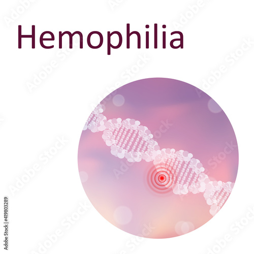 Hemophilia. Genetic. DNA double helix. Medical illustration.
