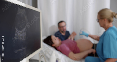 Sonographer scanning and examining pregnant woman while expecting father holding her hand