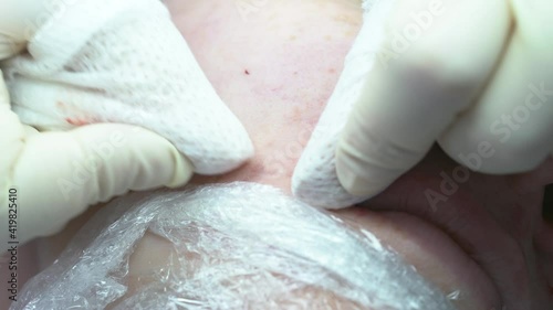 facial cleansing, black spot removal, cosmetology, acne removal, procedure with a cosmetologist