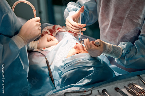 Rhinoplasty men, the surgeons gloved hands hold the instruments during nose surgery Doctor in gloves holds medical instrument during rhinoplasty