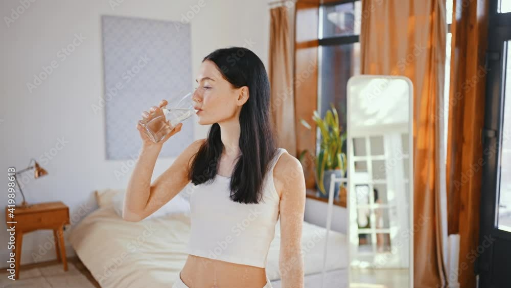 Tracking shot of young lady with uneven pigmentation drinking fresh water from glass at home Tracking shot of young lady with uneven pigmentation drinking fresh water from glass at home