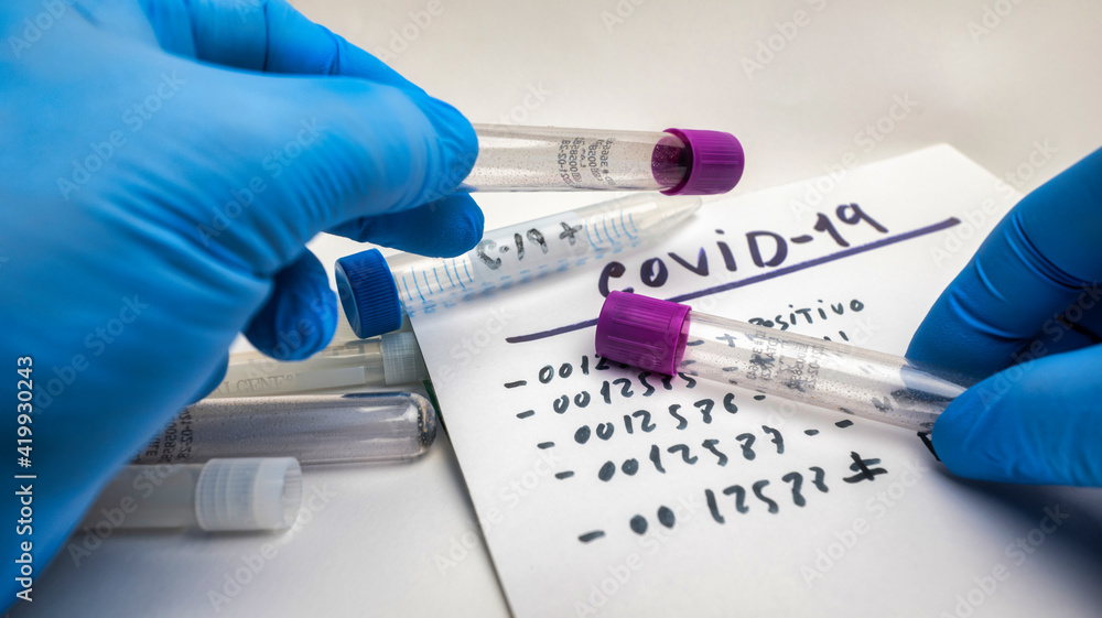 Scene of hands of nurse with blue latex gloves and test tube with covid-19 samples with positive result. Scene of hands of nurse with blue latex gloves and test tube with covid-19 samples with positive result.