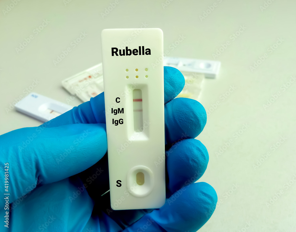 Lab scientist hold a device of Rubella Virus rapid screening test
