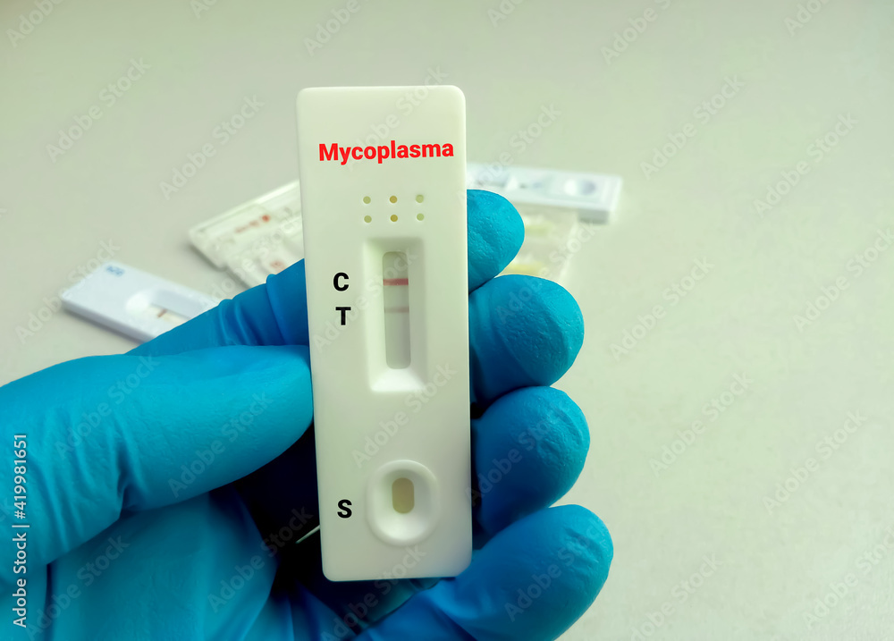 Rapid screening test of Mycoplasma showing positive result. Medical device. Rapid test cassette Rapid screening test of Mycoplasma showing positive result. Medical device. Rapid test cassette