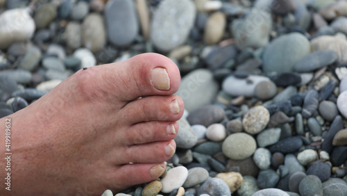 Leg of an old man on a pebble beach