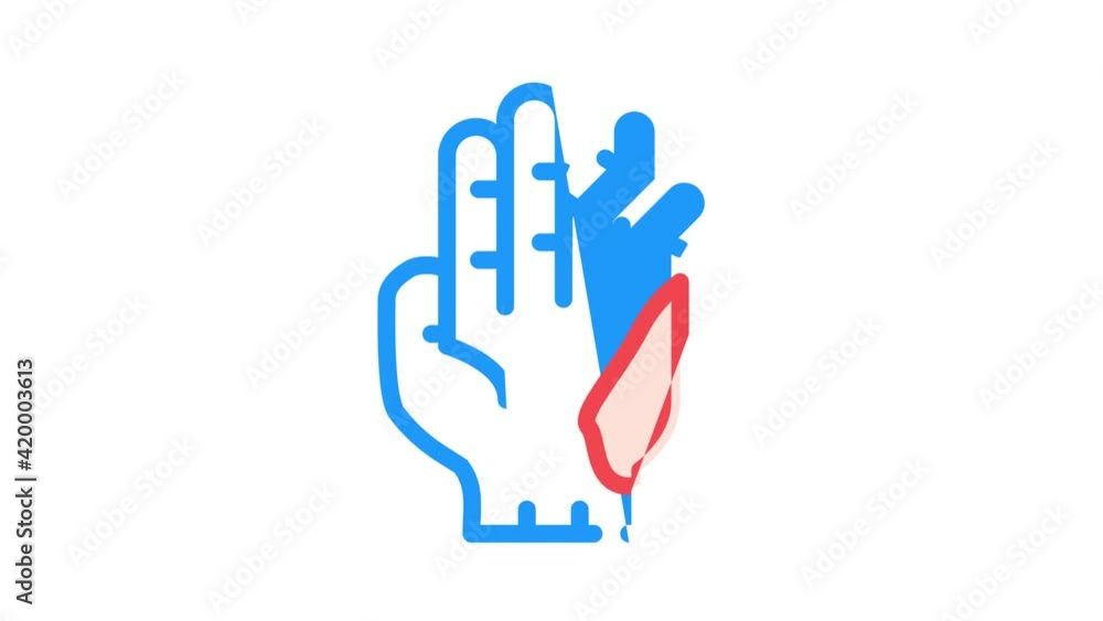 displaced fracture color icon animation displaced fracture color icon animation