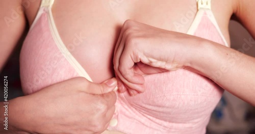 reddened breast feeding mothers. Close-up of a girl breast suffering from mastitis or lactostasis. slow motion